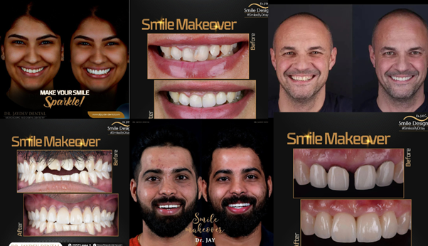 Smile-Makeover-for-Busy-Professionals-banner