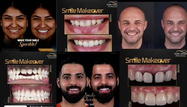 Smile-Makeover-for-Busy-Professionals-banner