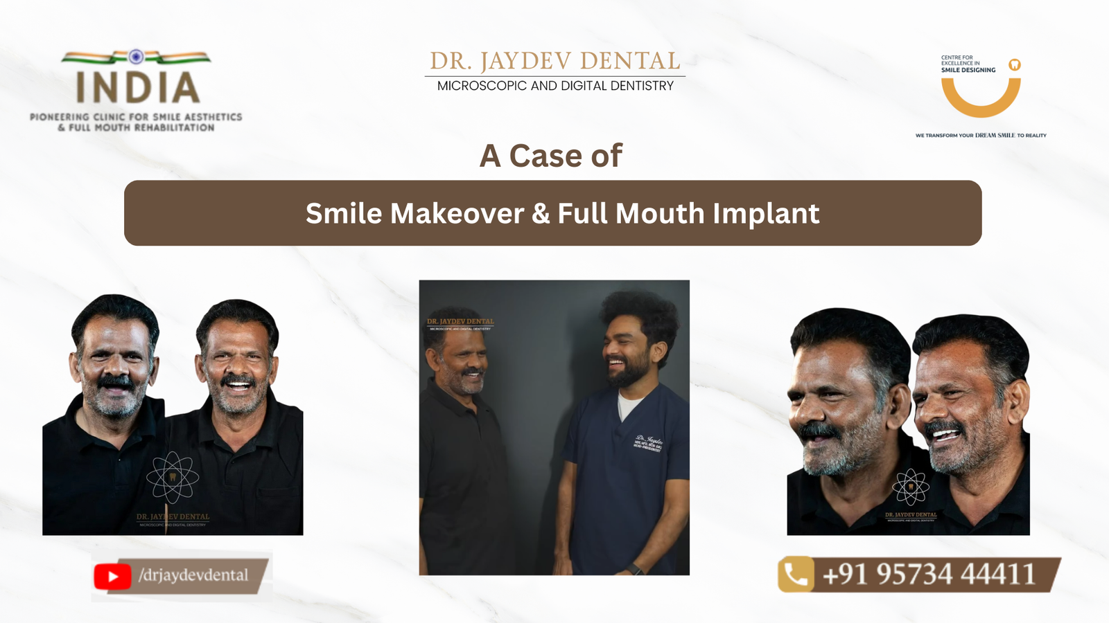 Case-study-banner-of-smile-makeover-and-full-mouth-implant