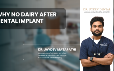 Why No Dairy After Dental Implant
