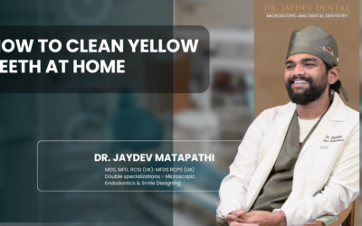 How to Clean Yellow Teeth at Home