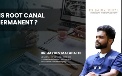 Is Root Canal Permanent?