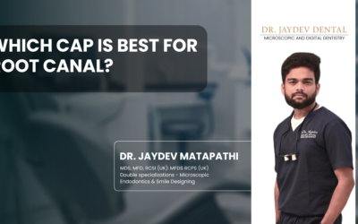 Which Cap Is Best for Root Canal