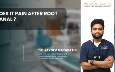 Does It Pain After Root Canal ?