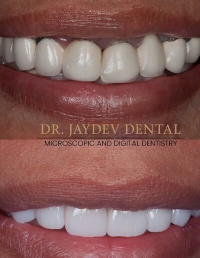 failed-smile-design-case