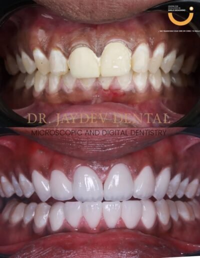 Before-and-after-image