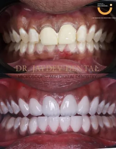 Before-and-after-image