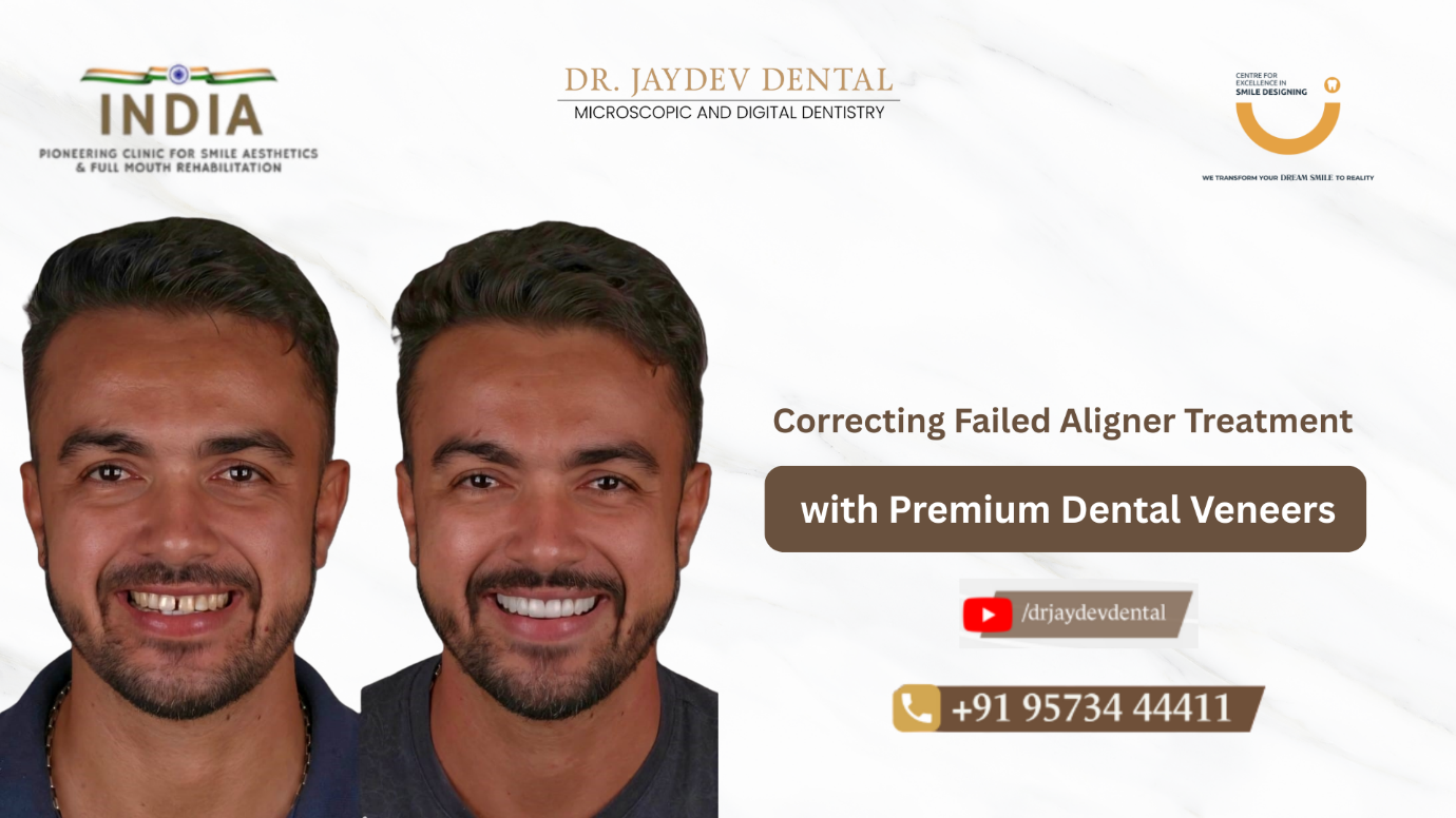 159e2326-a85b-497d-a598-cc2d6aecbb56 2 | Jaydev Dental Dr-Jaydev-Dental-Case-Study-Banner