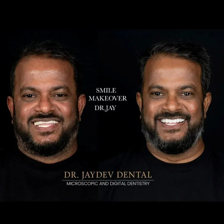 58417655-fc92-4bb6-86be-d7948e9b2127 smile-makeover-before-after-Dr-Jaydev-dental