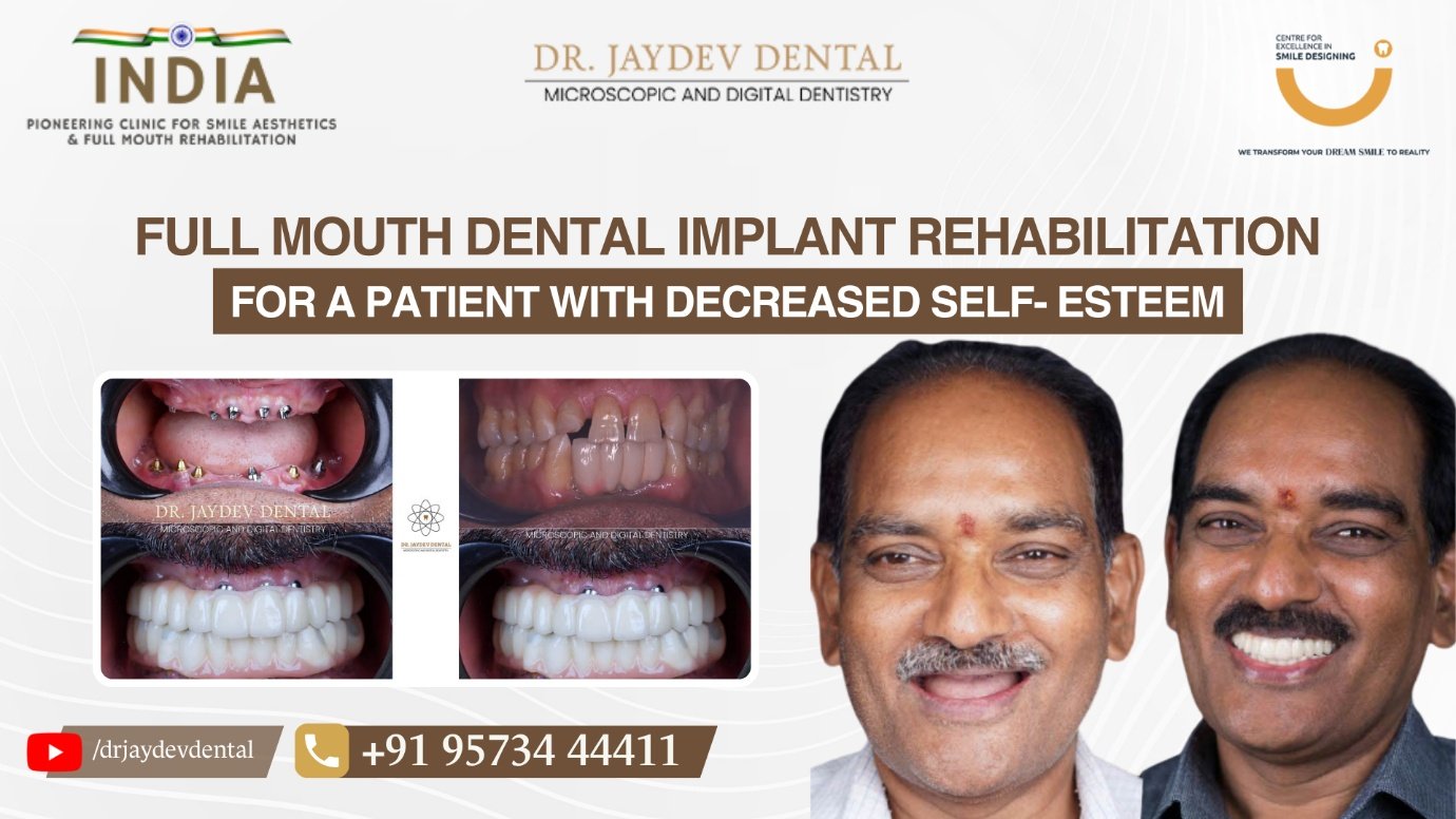 8bb713f2-e539-47e1-9a21-73022b114f3d | Jaydev Dental Dr-Jaydev-Dental-Case-Study-Banner