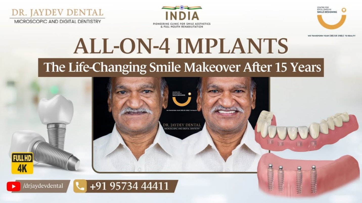 92a02842-d608-485f-a888-5f3a71746cdc | Jaydev Dental Dr-Jaydev-Dental-Case-Study-Banner