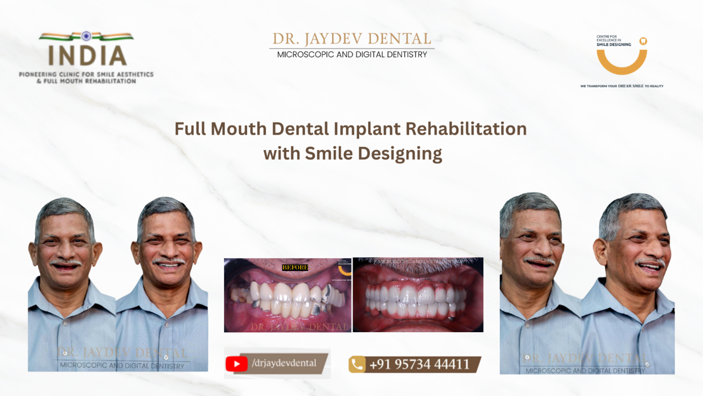 Picture2 | Jaydev Dental Dr-Jaydev-Dental-Case-Study-Banner