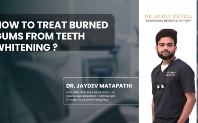 How to Treat Burned Gums From Teeth Whitening