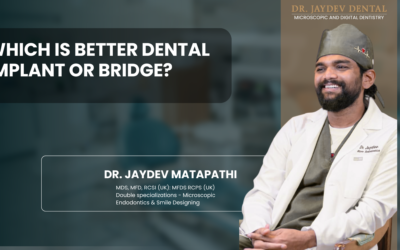 Which is better, a dental implant or a bridge?