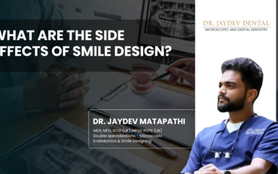 What Are the Side Effects of Smile Design?