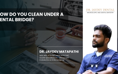 How Do You Clean Under a Dental Bridge?