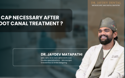 Is Cap Necessary After Root Canal Treatment ?