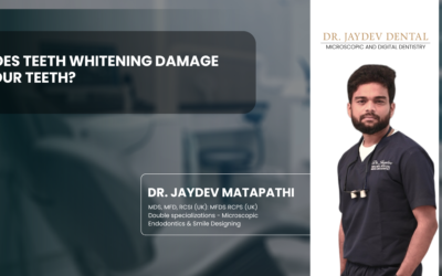 Does Teeth Whitening Damage Your Teeth?
