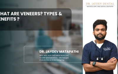 What Are Veneers? Types & Benefits ?