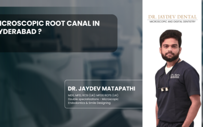 Microscopic Root Canal in Hyderabad ?