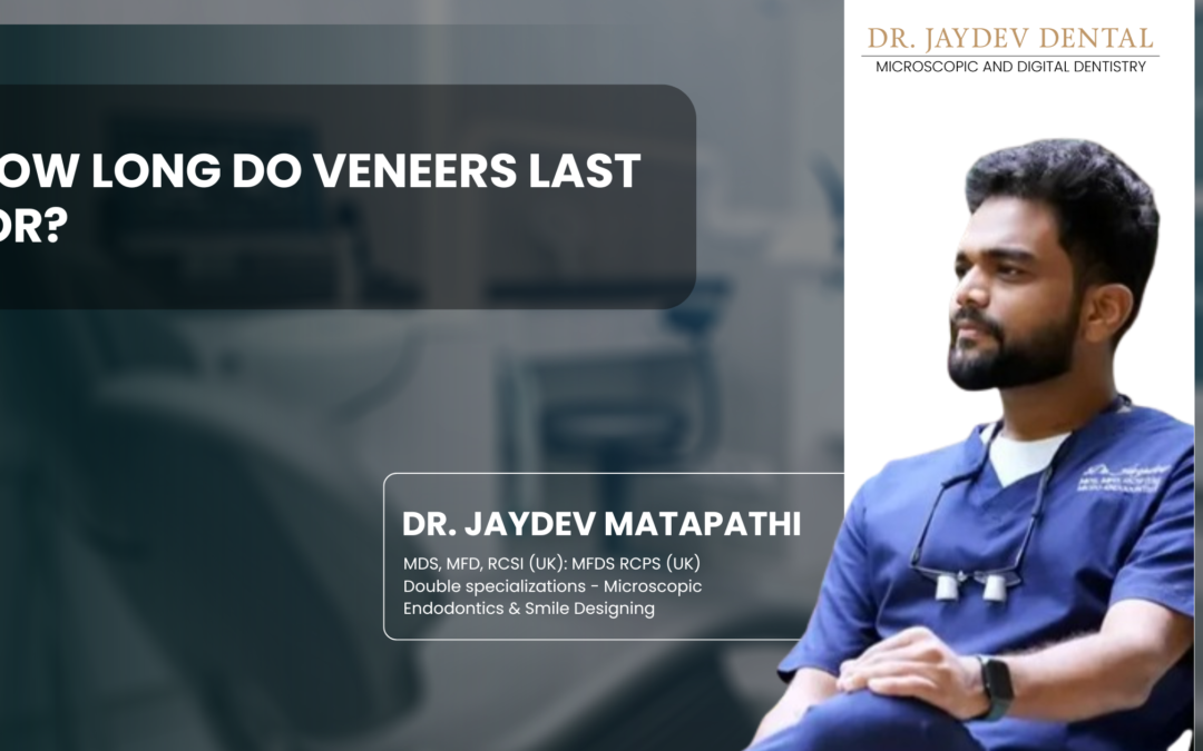 How Long Do Veneers Last For?