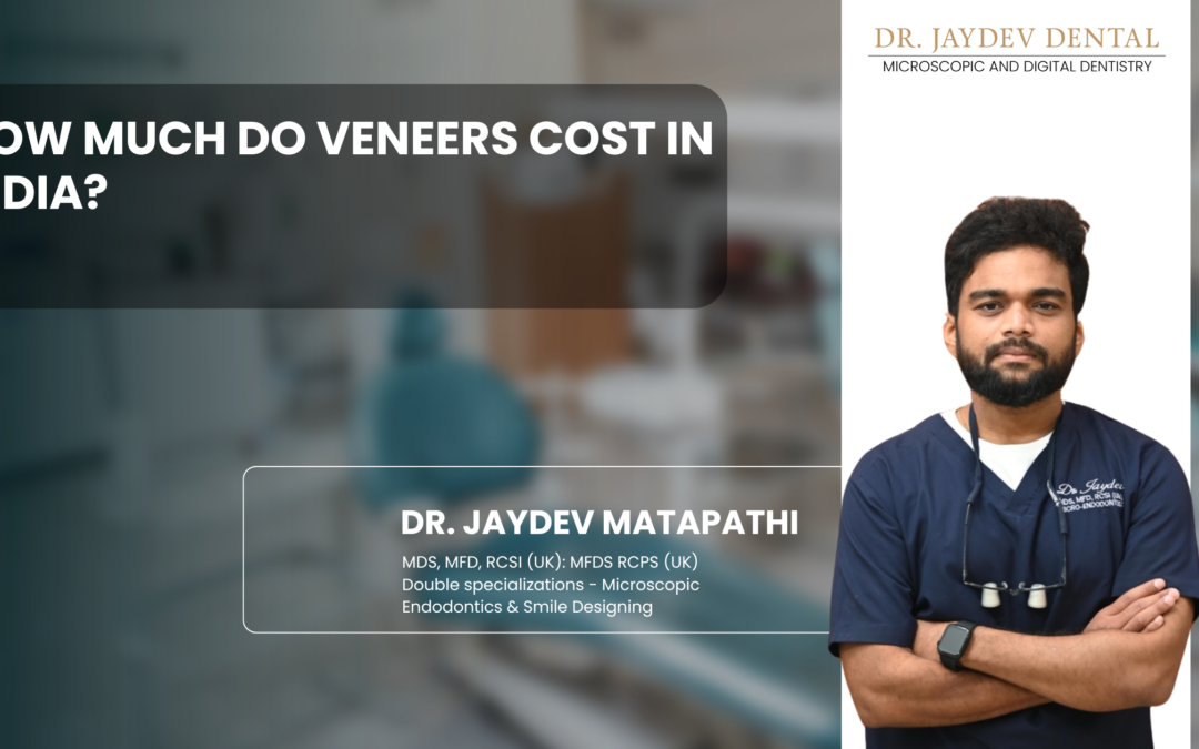 How Much Do Veneers Cost in India?