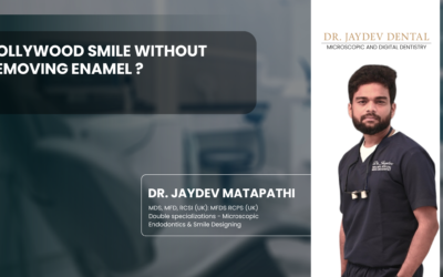 Hollywood Smile Without Removing Enamel