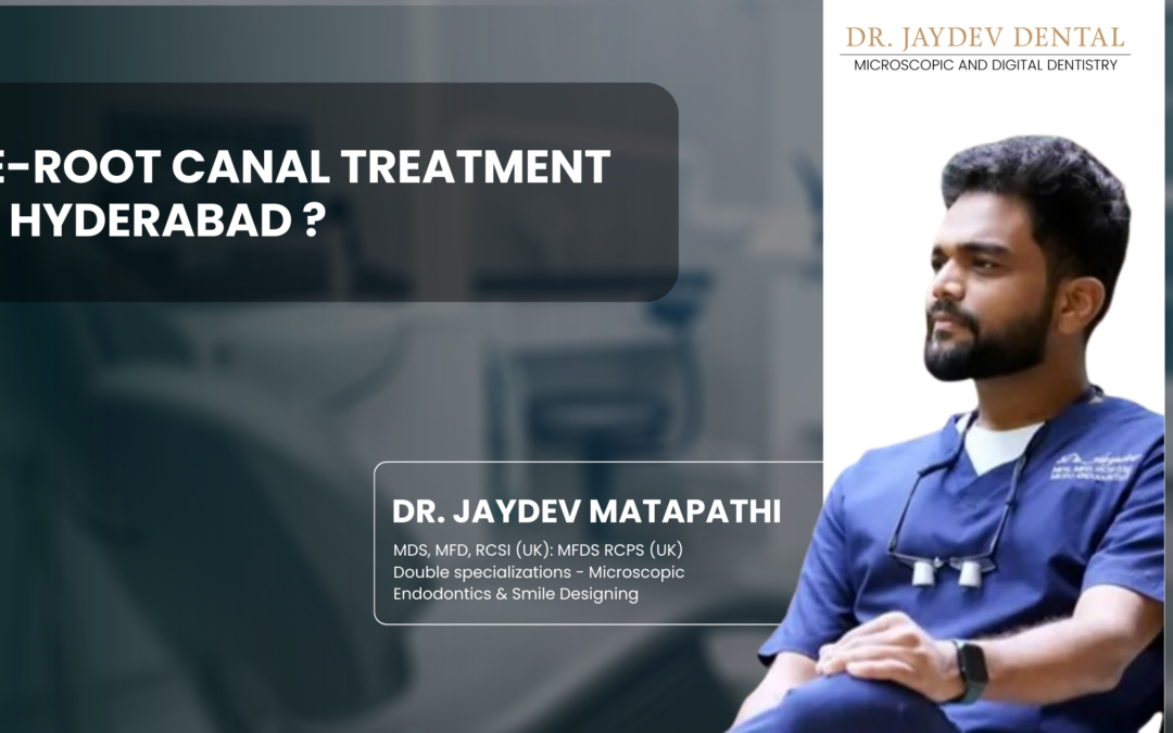 Re-Root Canal Treatment in Hyderabad ?