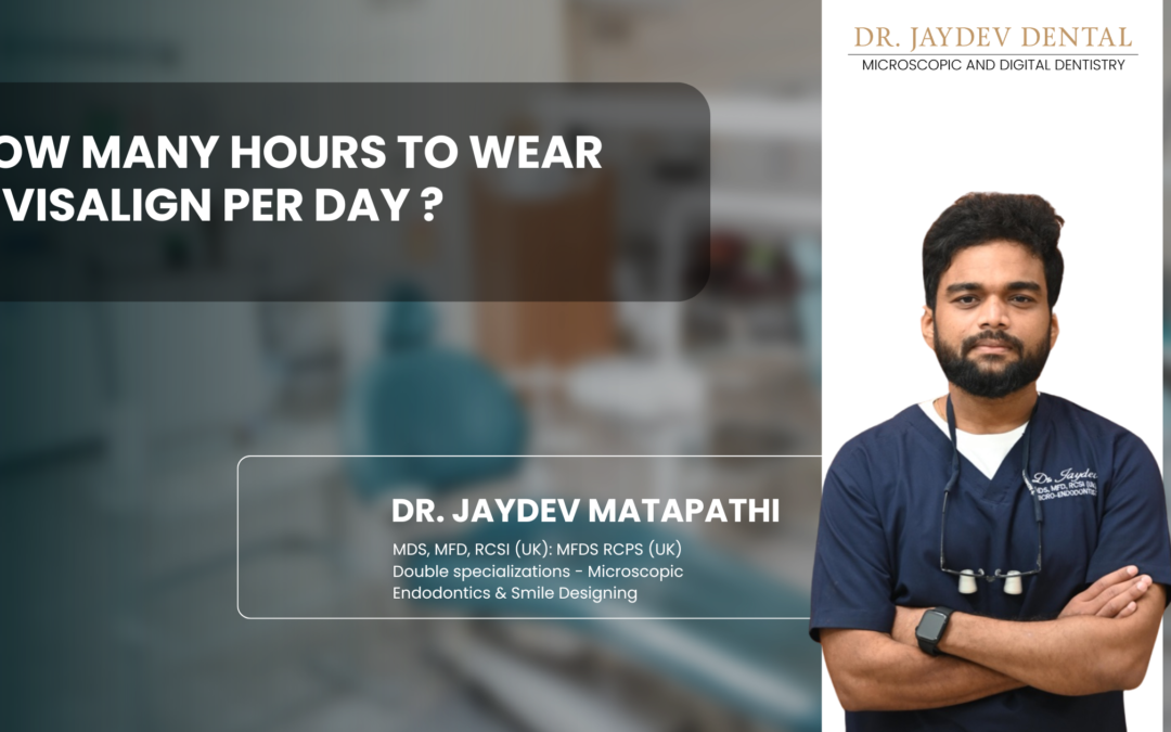 How Many Hours to Wear Invisalign Per Day ?