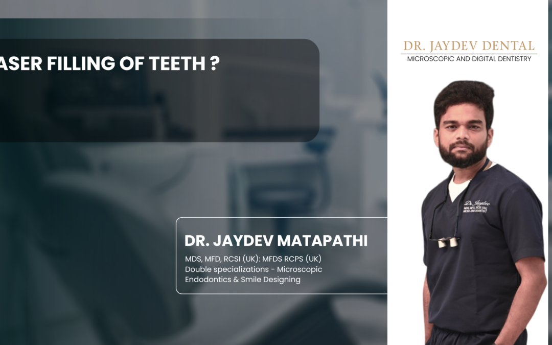 Laser Filling of Teeth ?