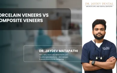 Porcelain Veneers vs Composite Veneers
