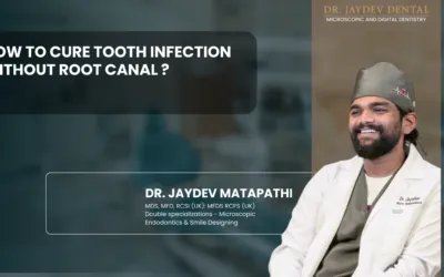 How to Cure Tooth Infection Without Root Canal ?