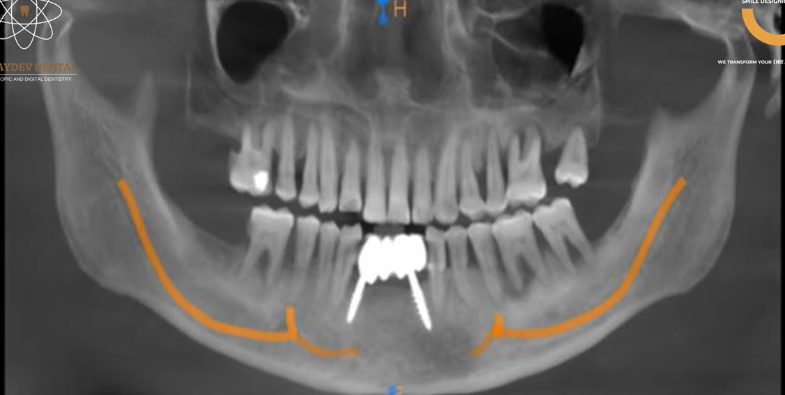 scan-image-Dr-Jaydev-Dental