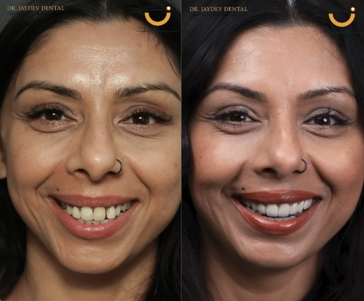 Dr-Jaydev-doing-dental-procedure