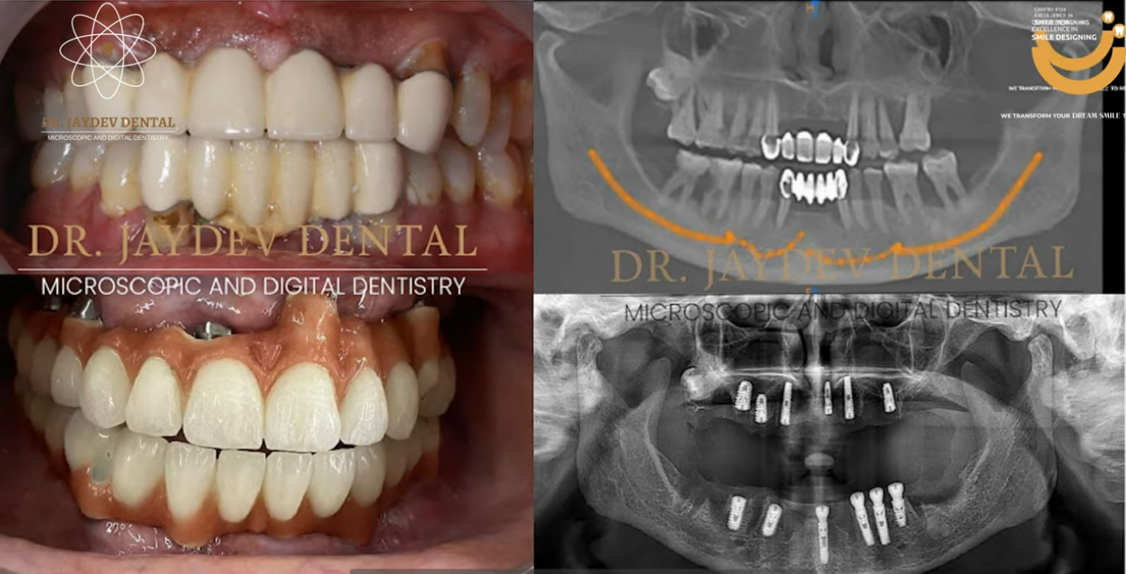 Dr-Jaydev-doing-dental-procedure