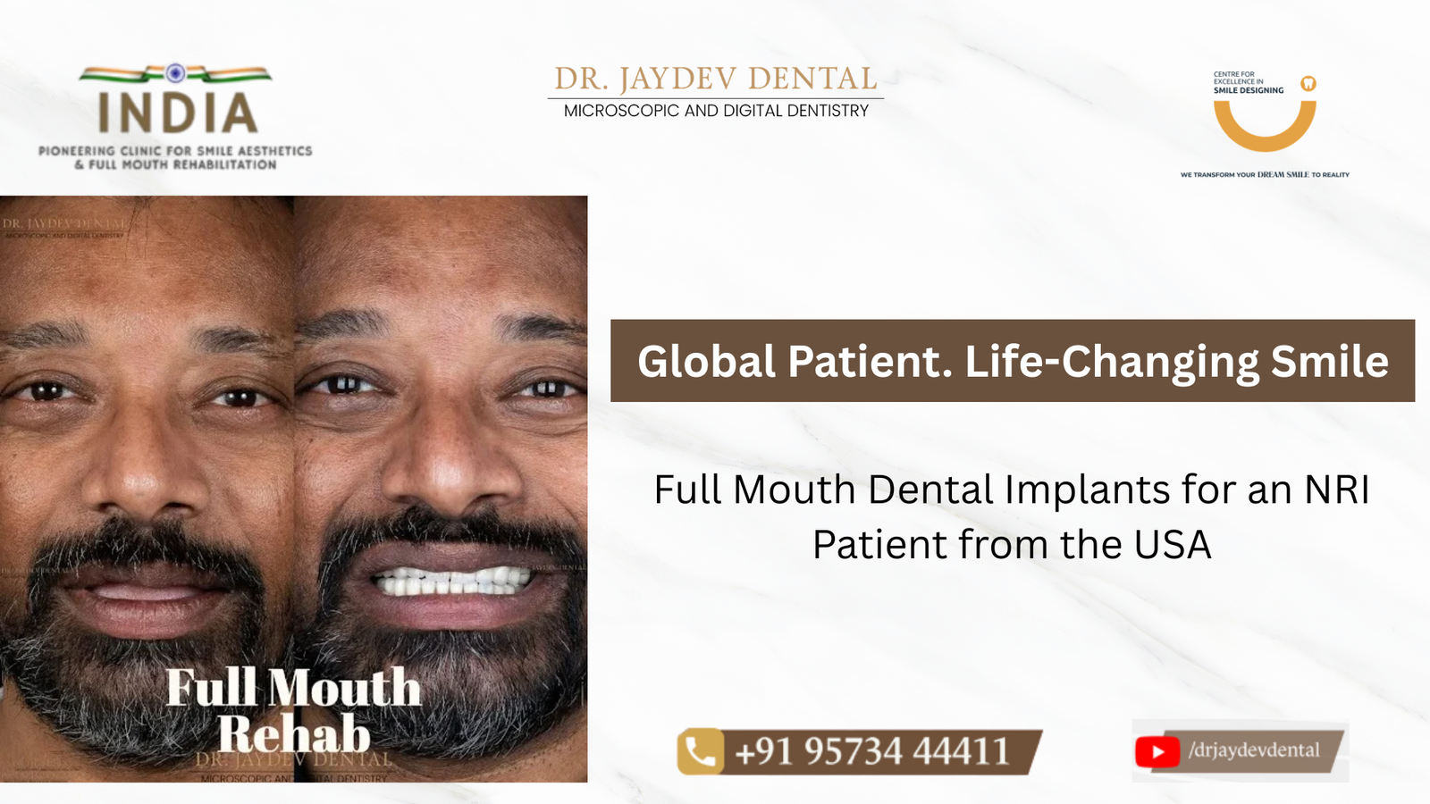 Dr-Jaydev-Dental-Case-Study-Banner