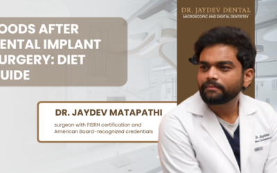  Foods After Dental Implant Surgery: Diet Guide