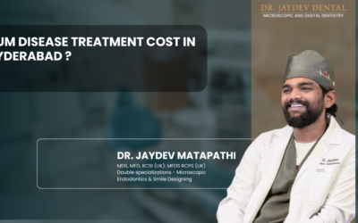 Gum Disease Treatment Cost in Hyderabad ?
