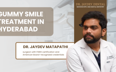 Gummy Smile Treatment Options Cost Results