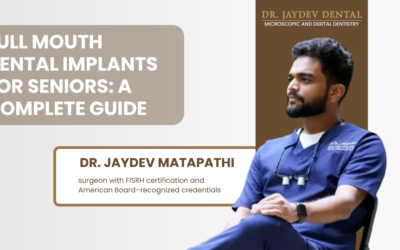 Full Mouth Dental Implants for Seniors: A Complete Guide