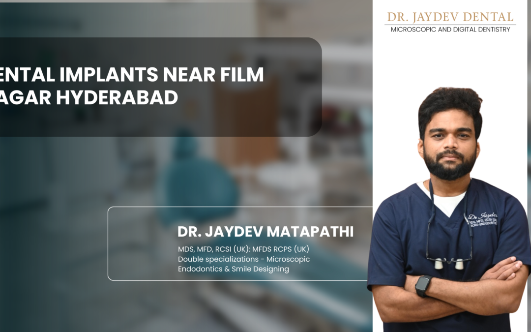 Dental Implants Near Film Nagar Hyderabad