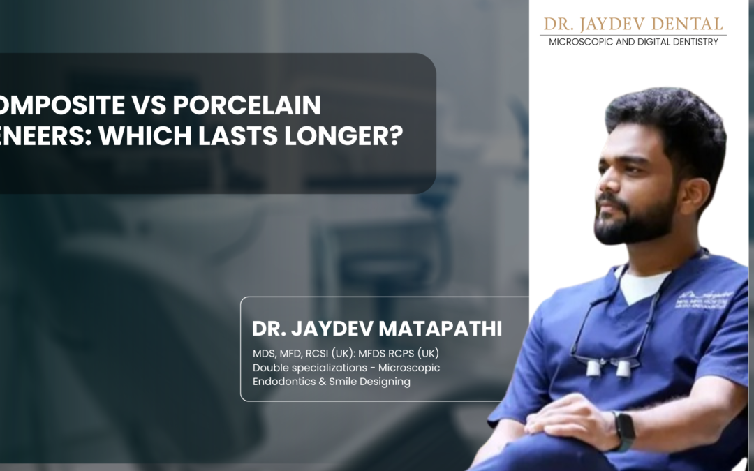 Composite vs Porcelain Veneers: Which Lasts Longer?