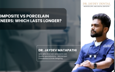Composite vs Porcelain Veneers: Which Lasts Longer?