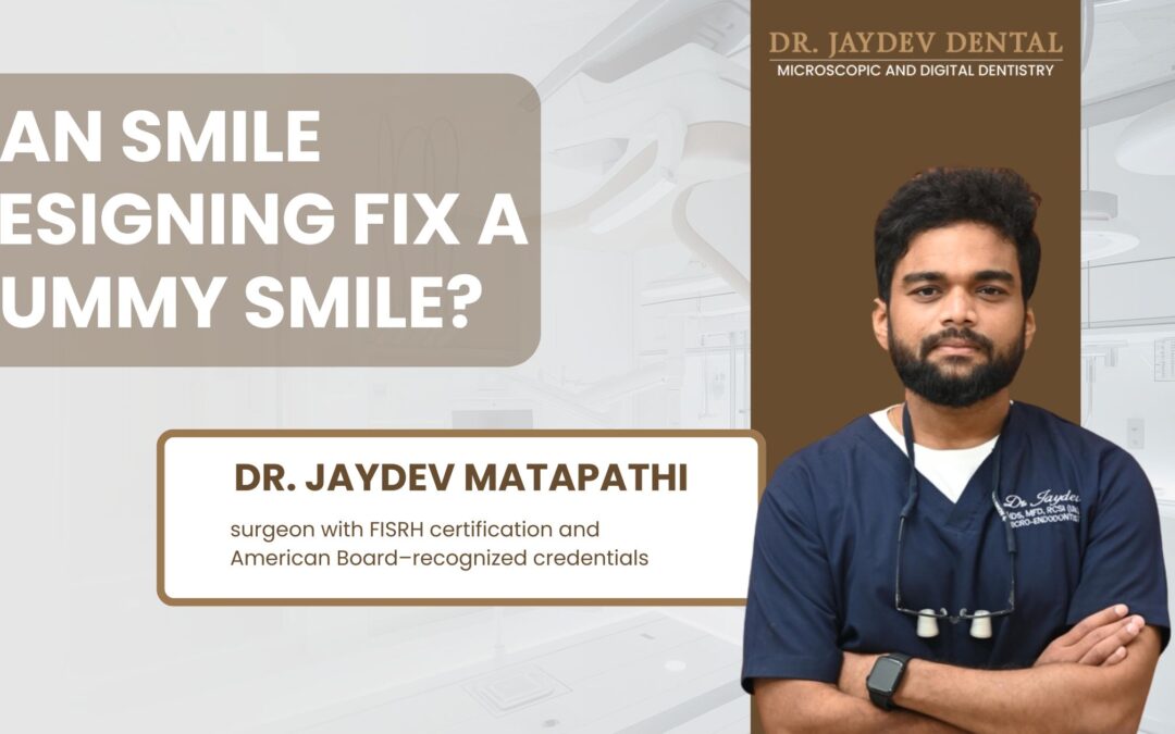 Can Smile Designing Fix a Gummy Smile