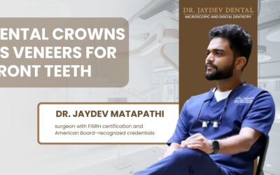Dental crowns vs veneers for front teeth: which gives a better smile?