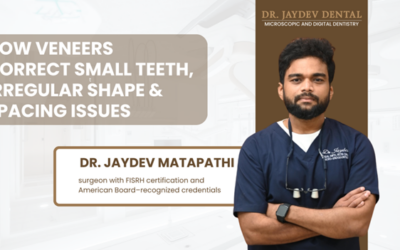 How Veneers Correct Small Teeth, Irregular Shape & Spacing Issues
