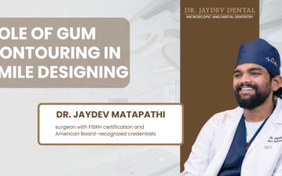 What is the role of gum contouring in smile designing?