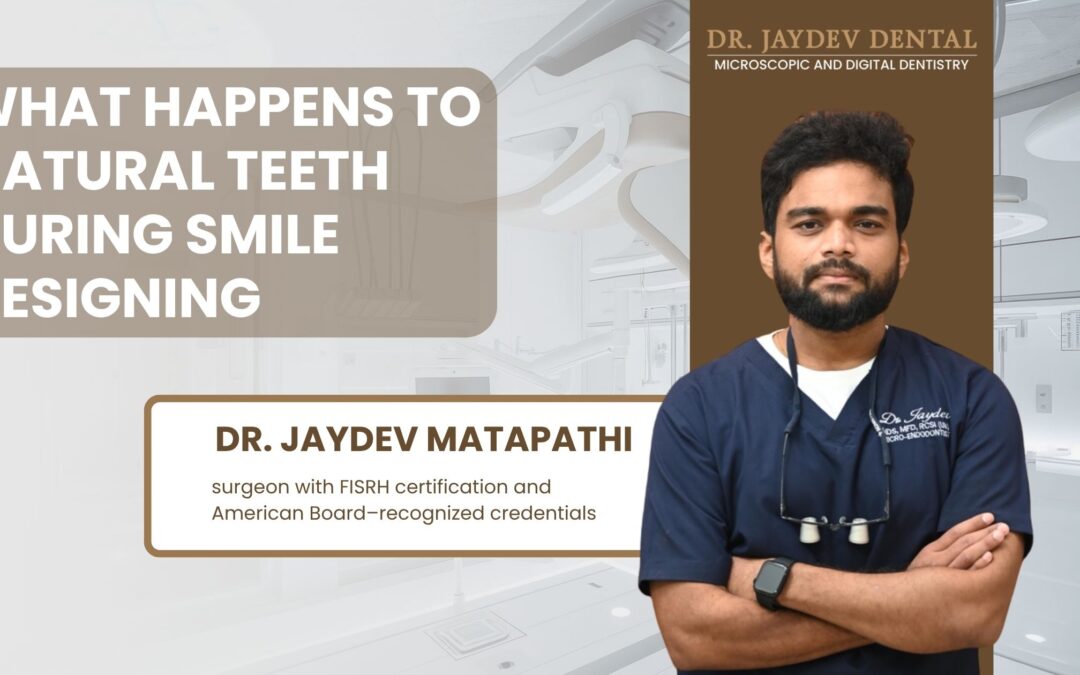What Happens to Natural Teeth During Smile Designing