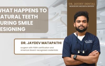What Happens to Natural Teeth During Smile Designing?