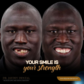 Two men smiling side by side in a dental clinic ad, with the slogan 'Your smile is your strength' and Dr. Jaydev Dental branding.